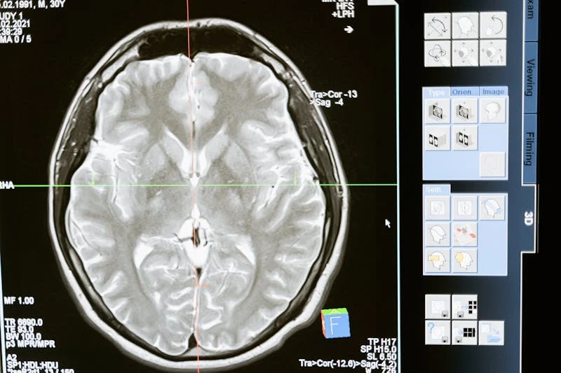 Scanning for neurological conditions - what does red light therapy do for neurological conditions.